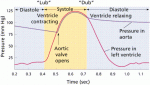 cardiaccycle.gif